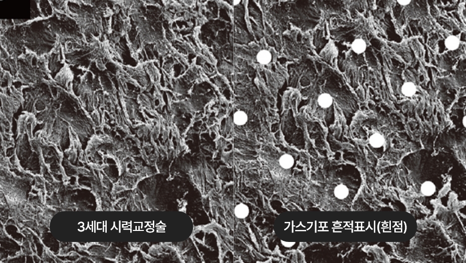 3세대 시력교정술 렌티큘 표면2