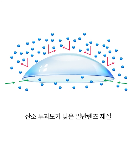 산소 투과도가 낮은 일반렌즈 재질